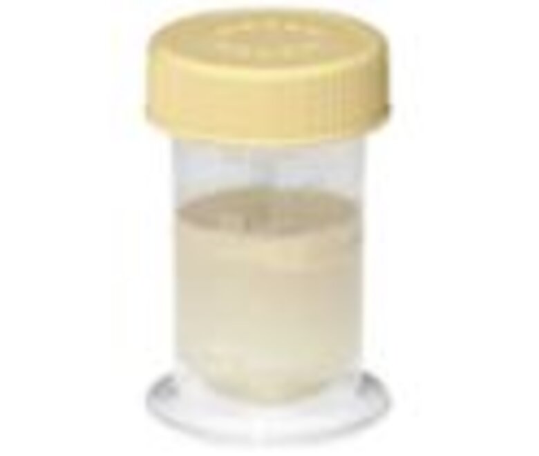 The Medela 35 ml Collection Container has a curved bottom that minimizes loss of colostrum or breast milk when transferring to a syringe.