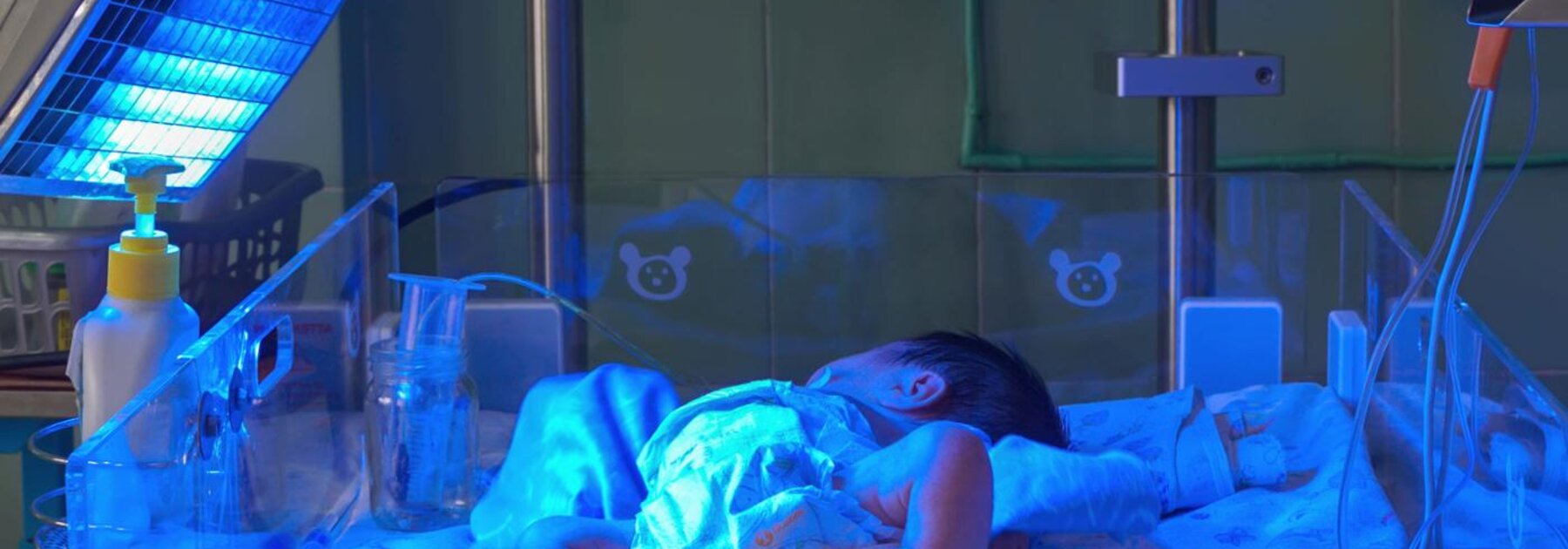 Premature baby differs from a full-term baby.