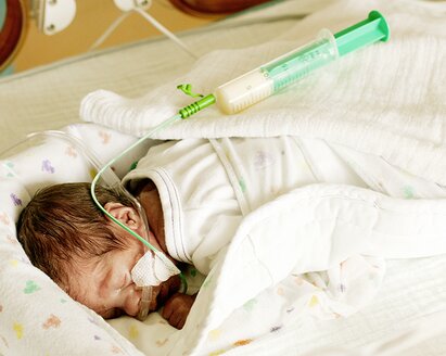 A premature baby in the NICU experiencing with feeding challenges.