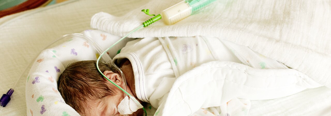 A premature baby in the NICU experiencing with feeding challenges.