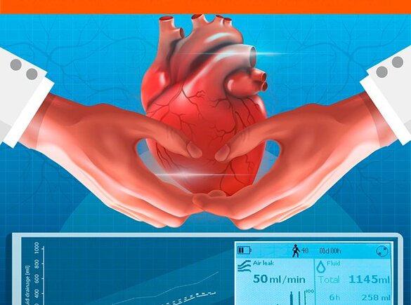De omslag van het Journal of Cardiac Surgery gewijd aan de praktijk van hartchirurgie bij volwassenen en kinderen, 2020, jaargang 35, nummer 7.