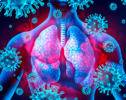 An illustration in shades of pink and blue of a human torso with lungs and the coronavirus floating around it.