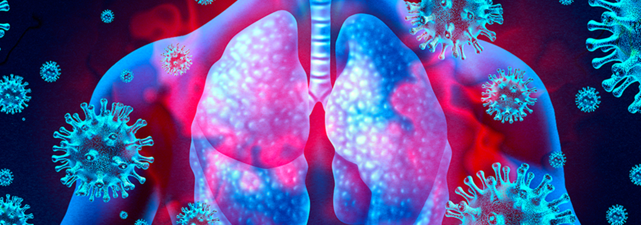 An illustration in shades of pink and blue of a human torso with lungs and the coronavirus floating around it.