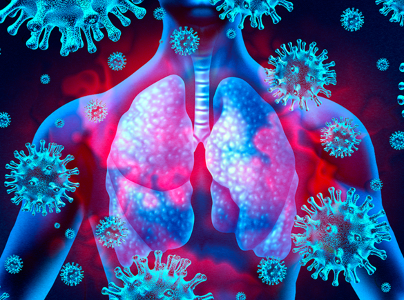 Een illustratie in roze en blauwe tinten van een menselijke romp met longen en het coronavirus dat eromheen zweeft.