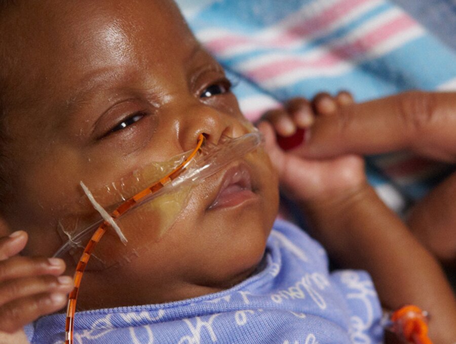 Een baby met speciale voedingsbehoeften houdt de vinger van zijn moeder vast.