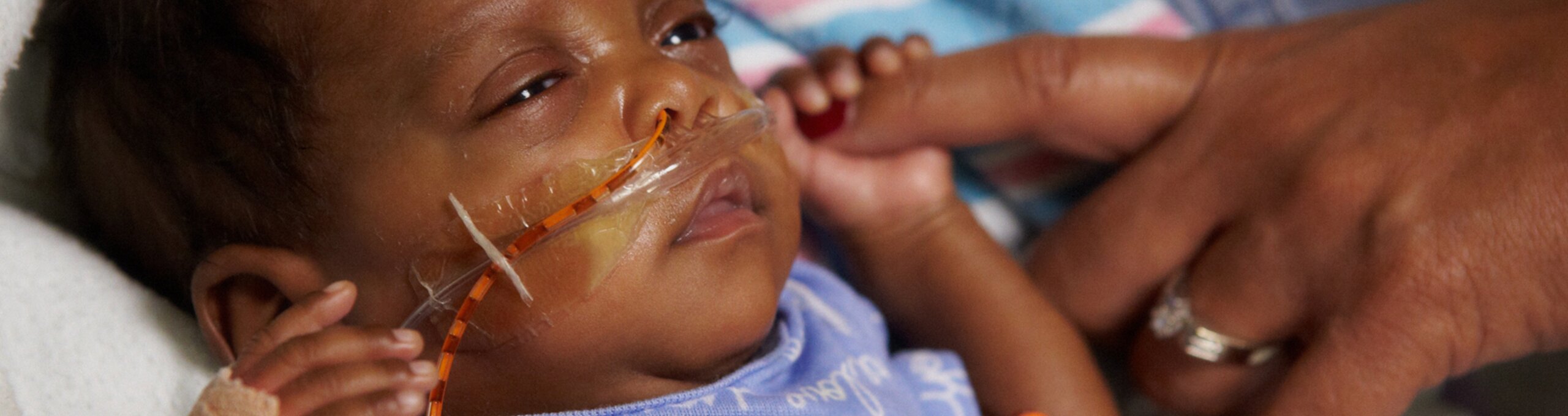 Un neonato con particolari esigenze di alimentazione tiene il dito della madre.