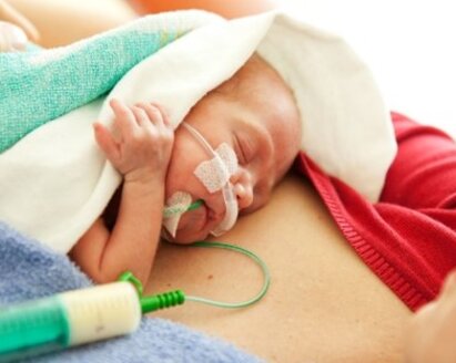 An infant with special feeding needs receives a dose of OMM, its own mother's milk, while lying on its mum's chest.