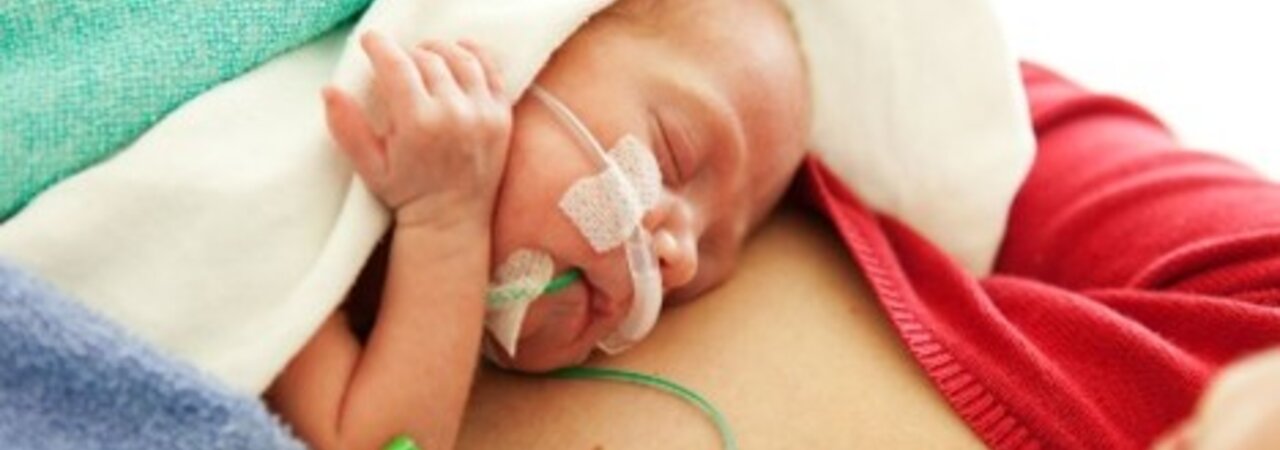 An infant with special feeding needs receives a dose of OMM, its own mother's milk, while lying on its mum's chest.