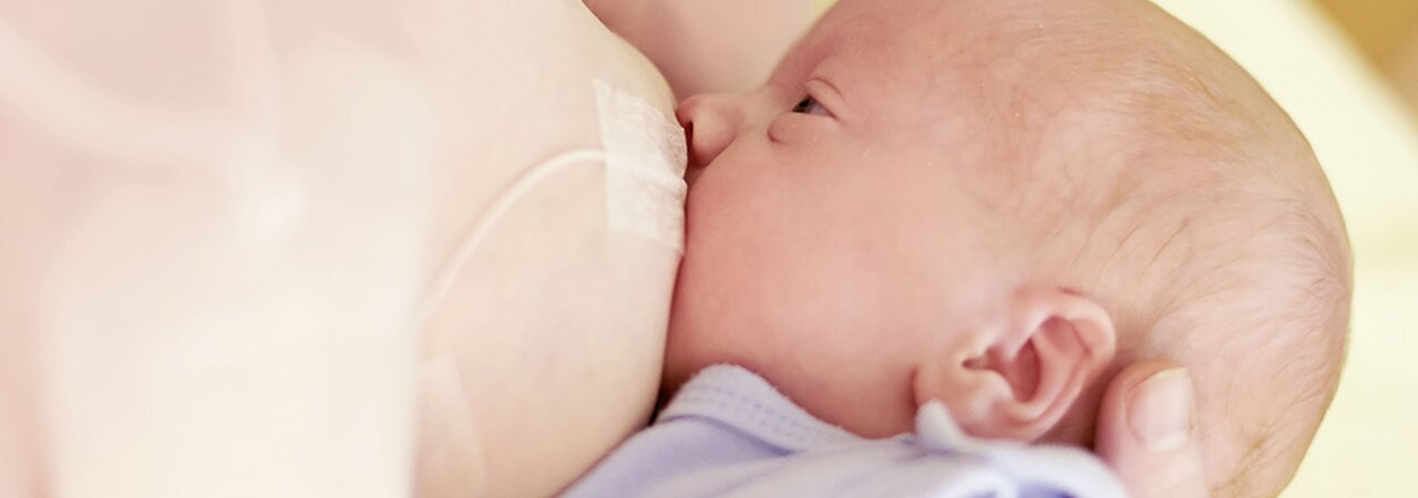 A mom breastfeeding her baby and supplementing the diet using Medela's Supplemental Nursing System™ (SNS).